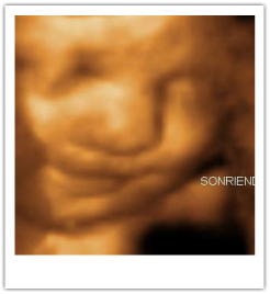 3D Ultrasound 30 Weeks