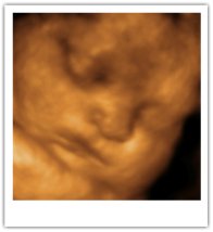 3D Ultrasound Pic - Kisses